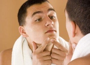 male acne treatments