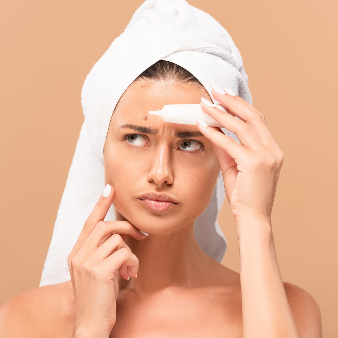 3 Biggest Skincare Mistakes that Aggravate Acne