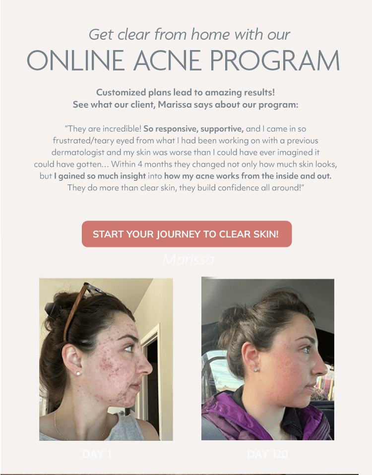 Online Acne Program