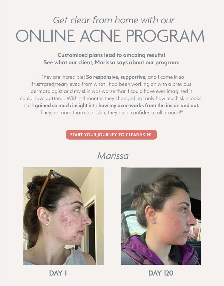 Online Acne Program